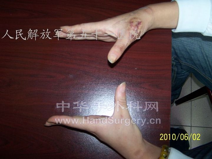100_8454.JPG