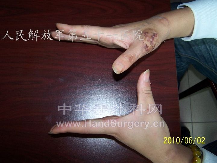 100_8452.JPG
