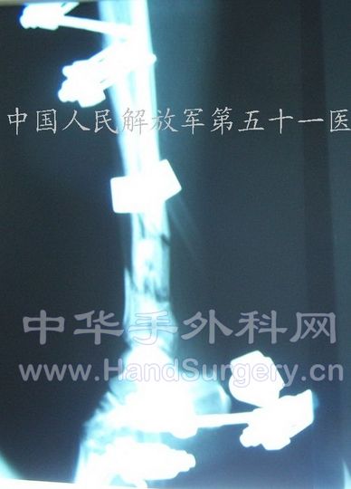 100_8498.jpg