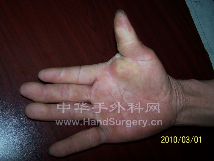 100_7268.JPG