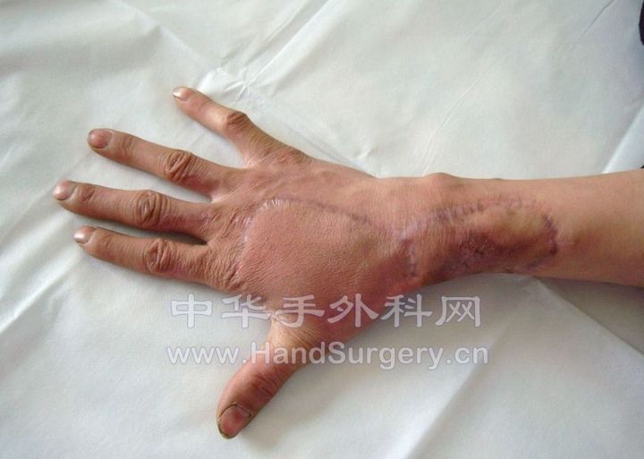 术后复查1.jpg