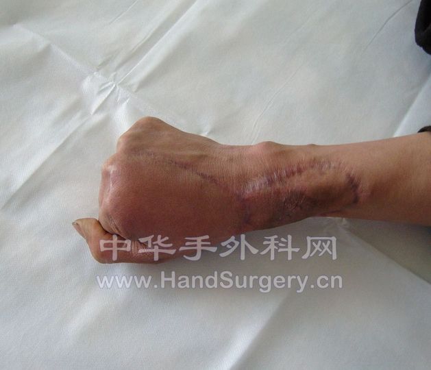 复查2.jpg
