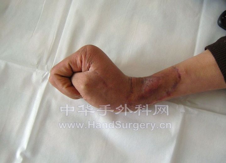 复查6.jpg