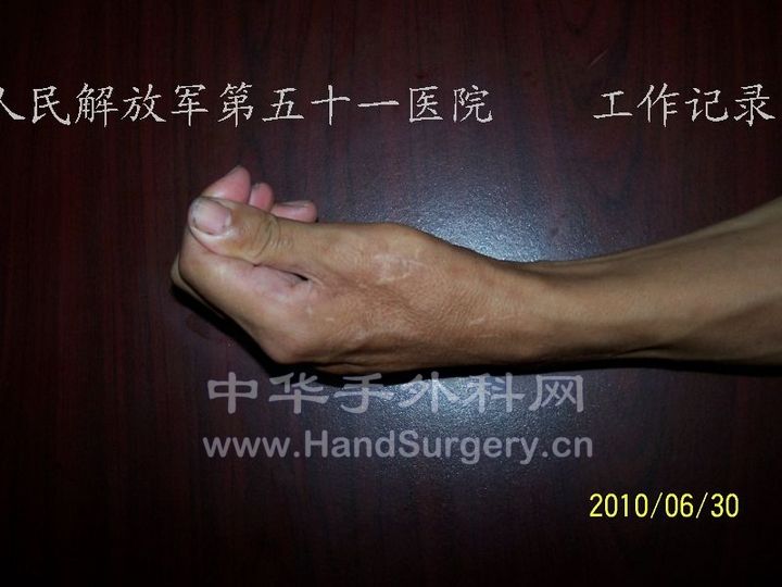 100_8954.JPG