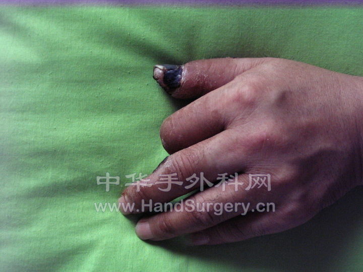 左手021.jpg