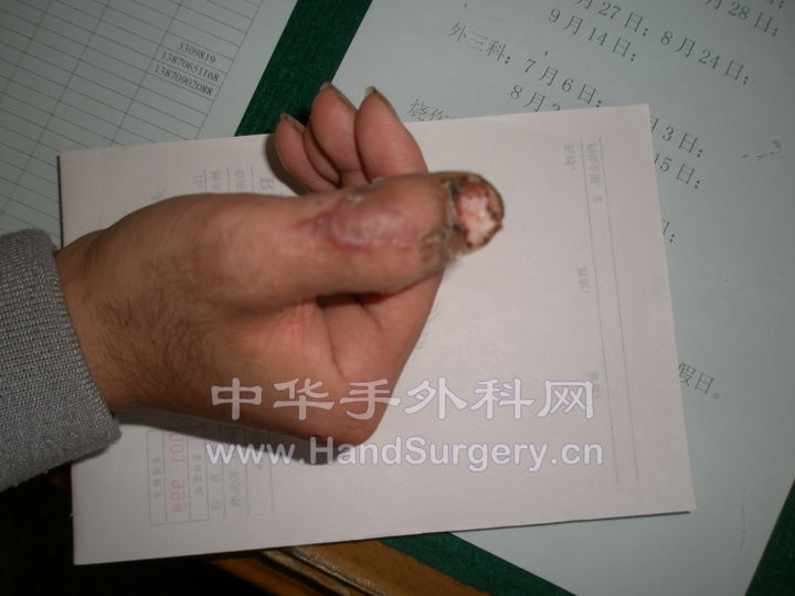 PB250632.JPG
