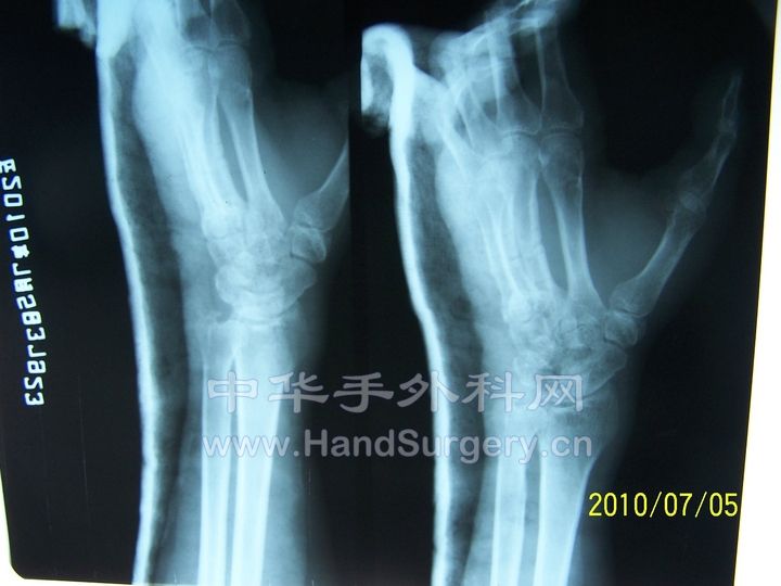 100_9037.JPG