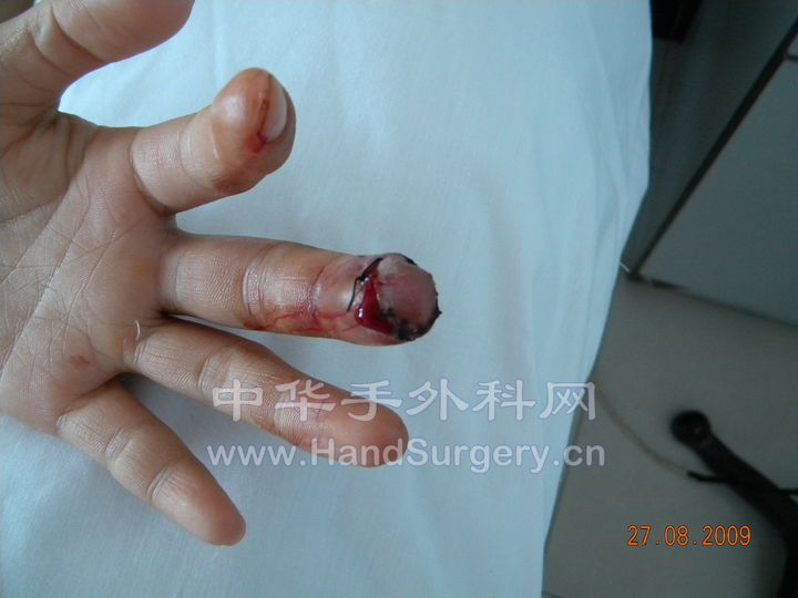 照片000000 128 (1).jpg