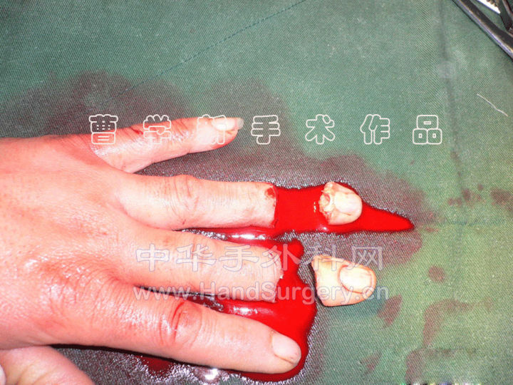 2.gif