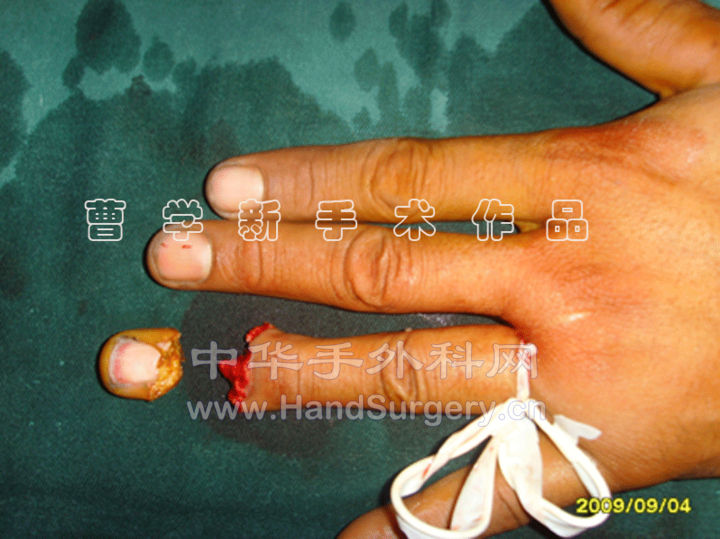 2.gif