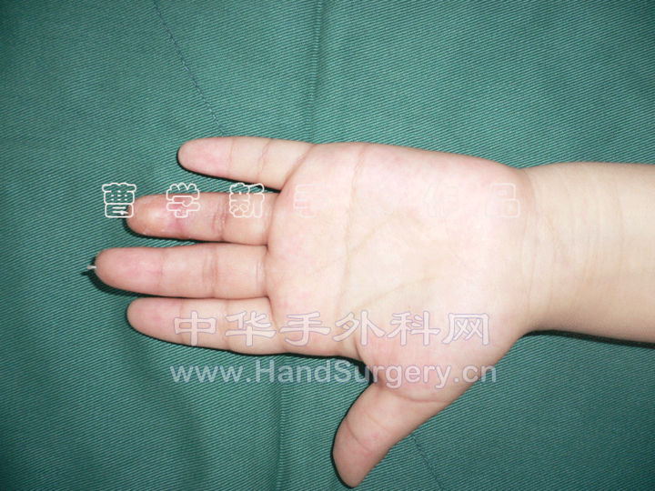 5.gif