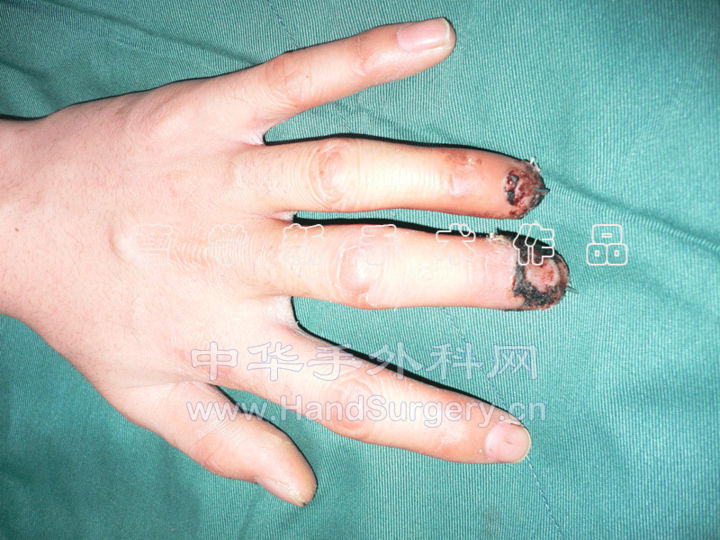 4.gif