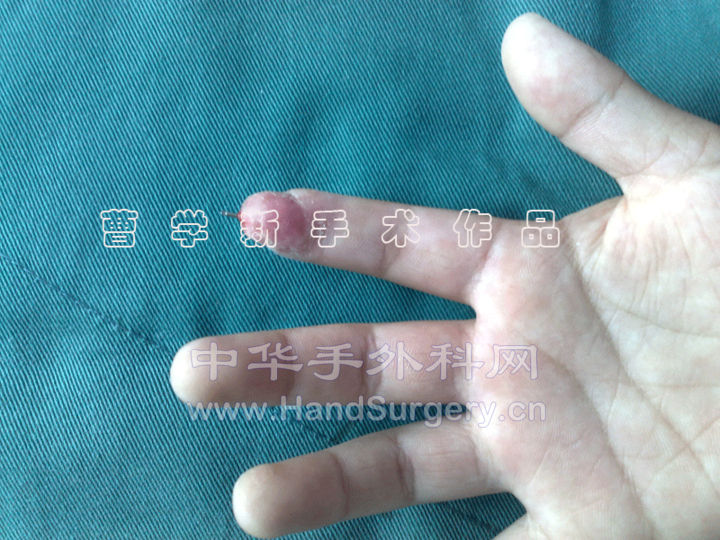 6.gif