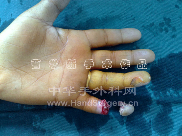 1.gif