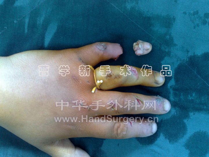 2.gif
