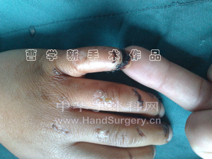 3.gif