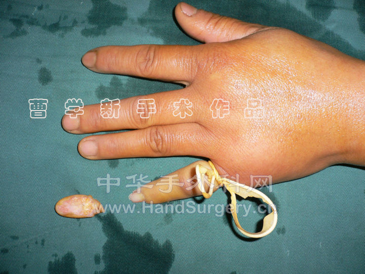 2.gif