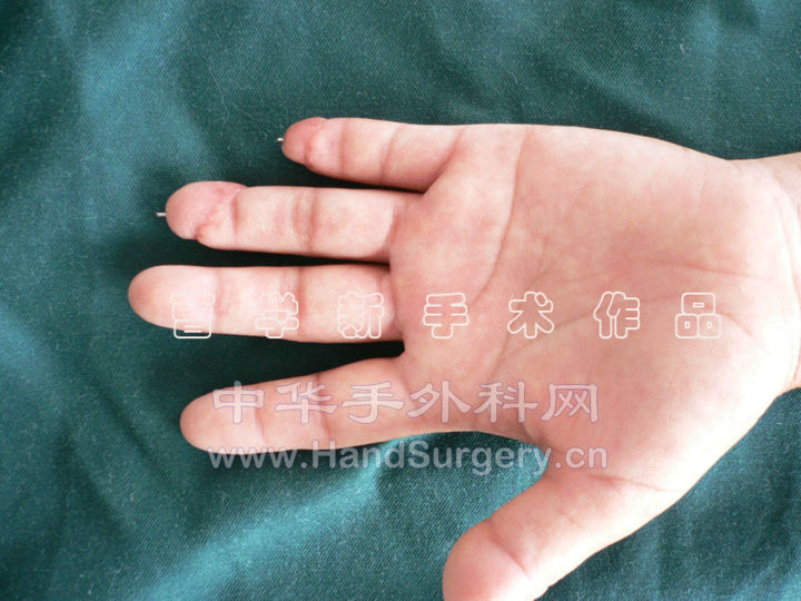 3.gif