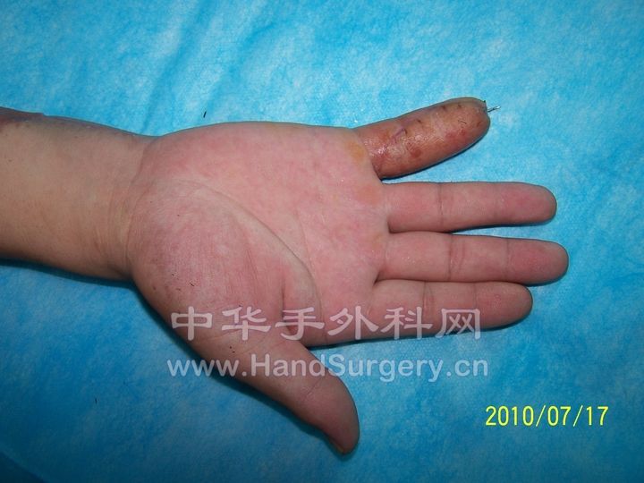 100_9171.JPG