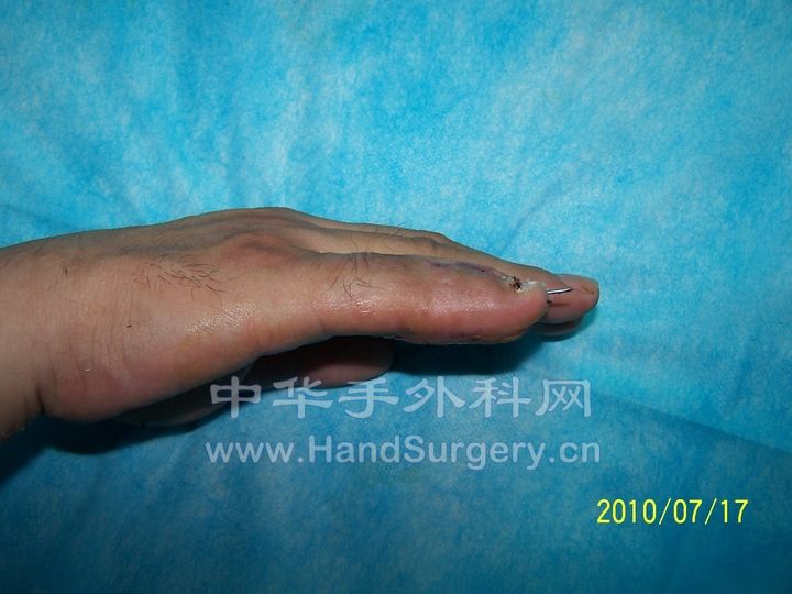 100_9172.JPG