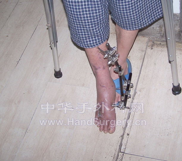100_9163.jpg