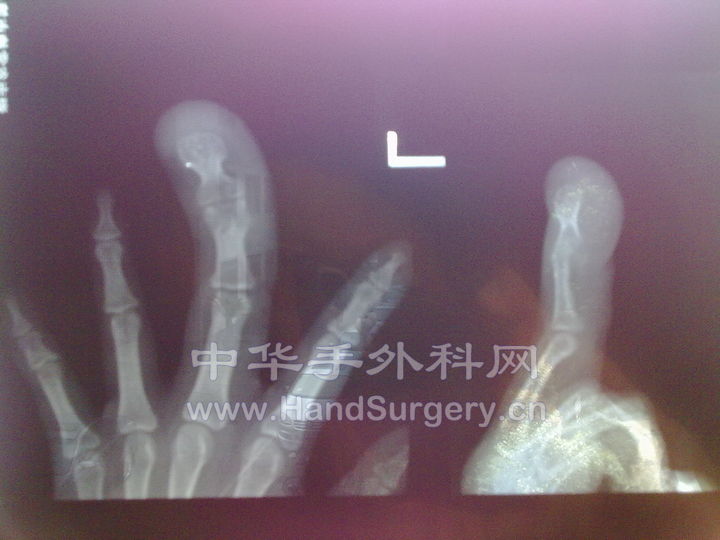 20100720635.jpg