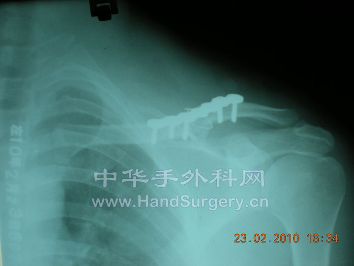 照片 061.jpg
