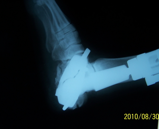100_9430.jpg