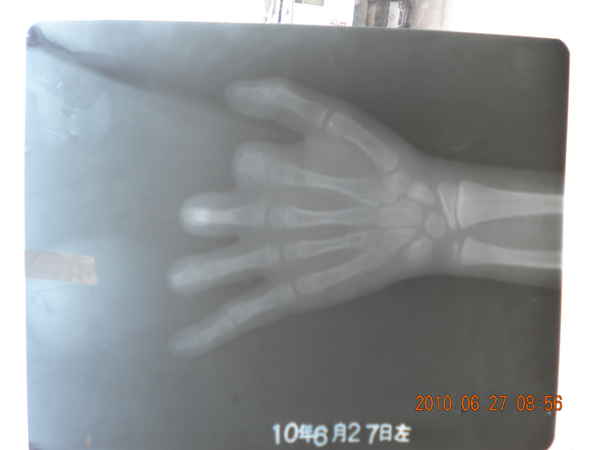 DSCN1518.JPG
