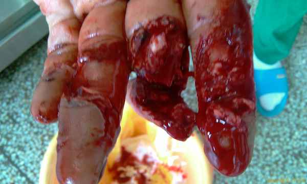 IMAG0225.jpg