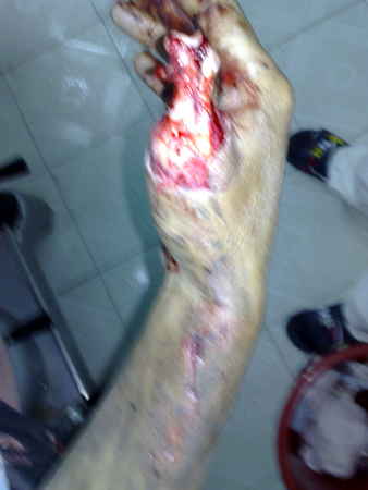 201005181423.jpg