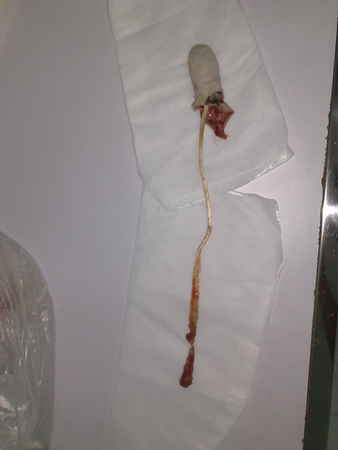 201005181425.jpg