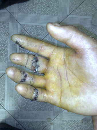 201005111414.jpg