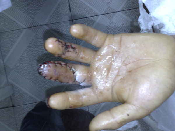 201006221508.jpg