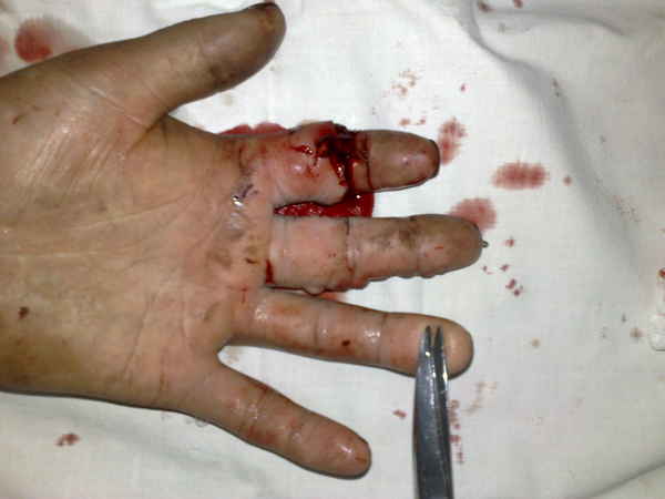 201007251595.jpg