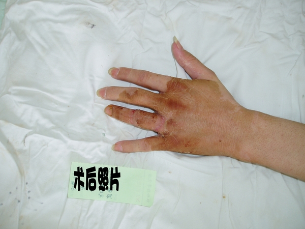阳黎明术后2_conew1.jpg