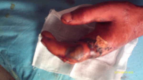 IMAG0036.JPG