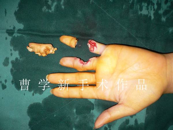 1.gif