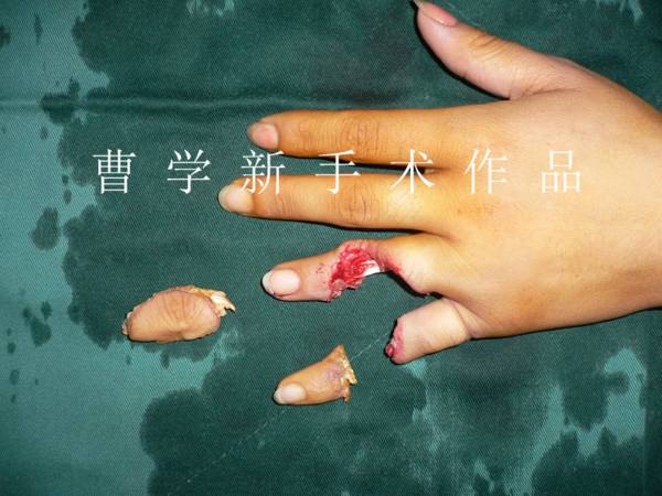 2.gif