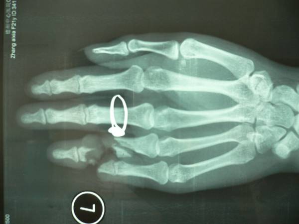 5.gif