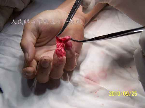 100_9749.JPG