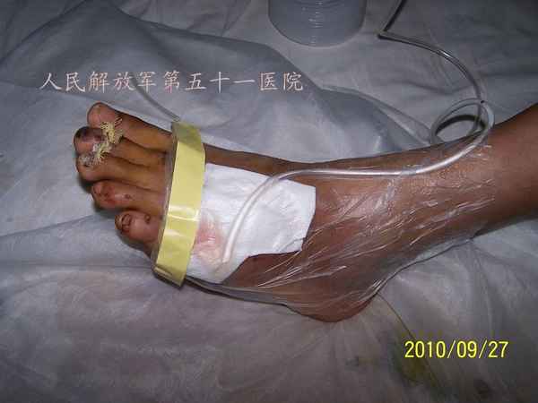 100_9751.JPG