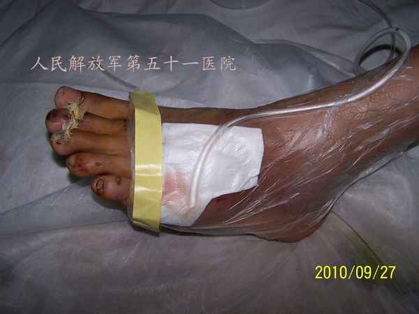 100_9752.JPG