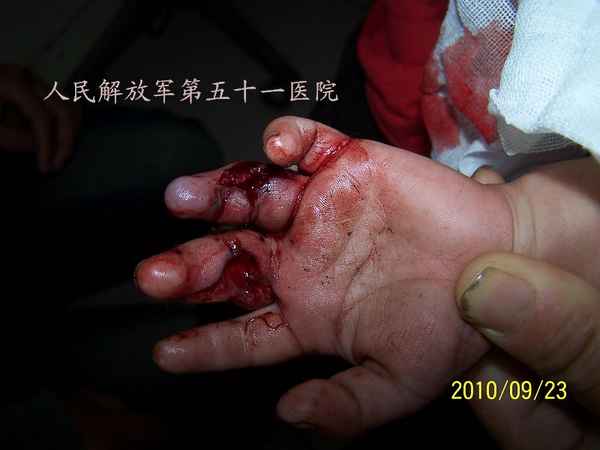 100_9687.JPG