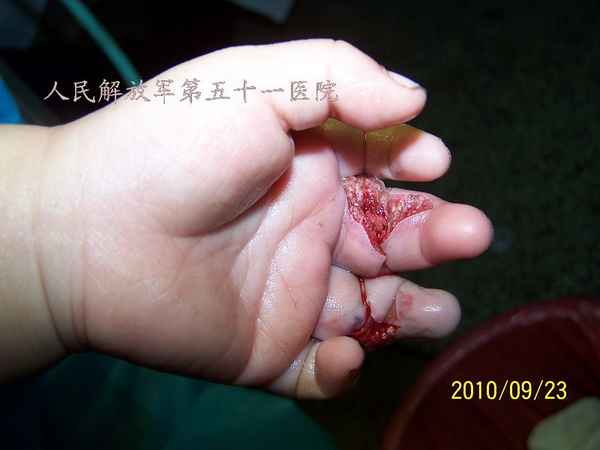 100_9690.JPG