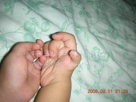 DSCN31451.jpg