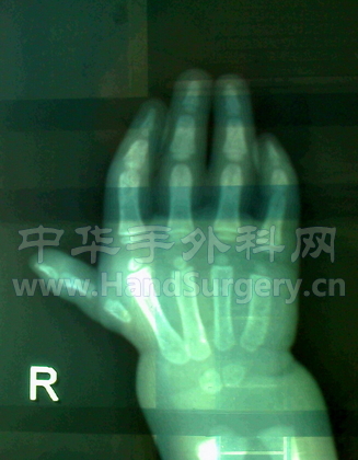 XP光片，今年5月份拍的