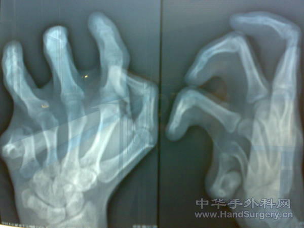20101023311.jpg