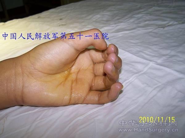100_0214.JPG
