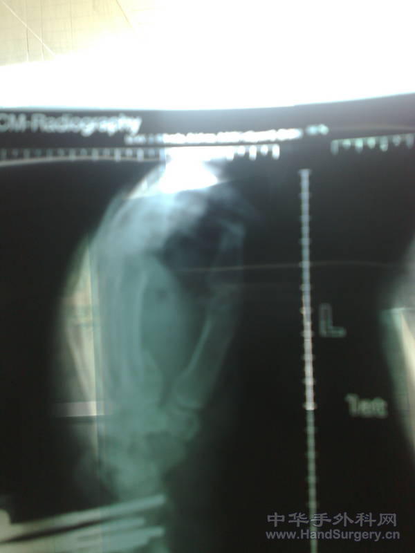 20101031153.jpg